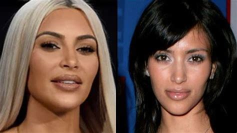 Kim Kardashian Before And After Plastic Surgery