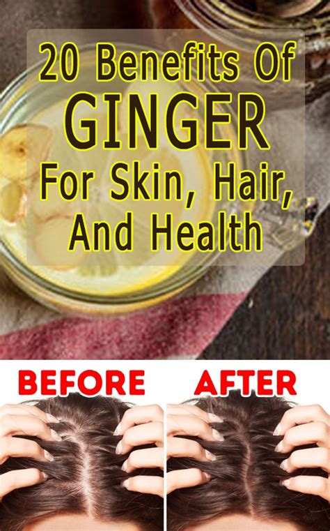 20 Surprising Benefits Of Ginger Adrak For Skin And Health
