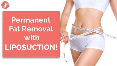 Liposuction Surgery Recovery Time Procedure Result Experience In