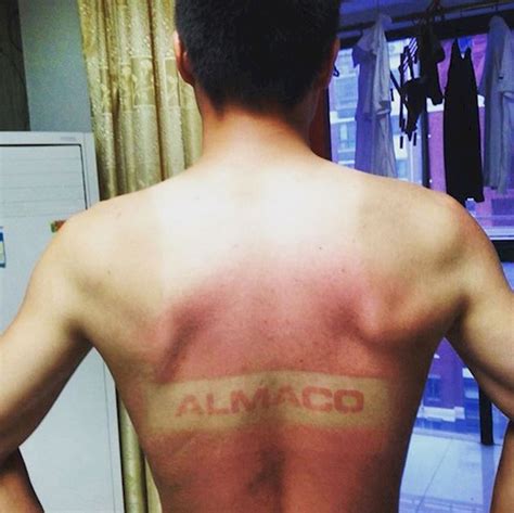 20 Hilarious Tan Lines Thatll Make You Never Want To Step Outside Again