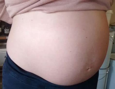 Part 2 No Pregnancy Stretchmarks At 34 Weeks Pregnancy Skincare