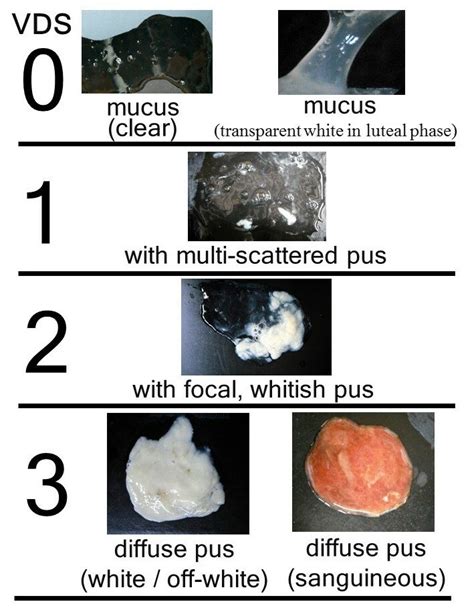 Photographs Showing Vaginal Mucus Discharges Assessed According