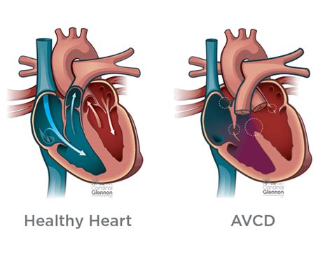 Pin On Fetal Heart Program