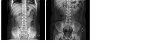 Normal Abdominal X Ray Download Scientific Diagram