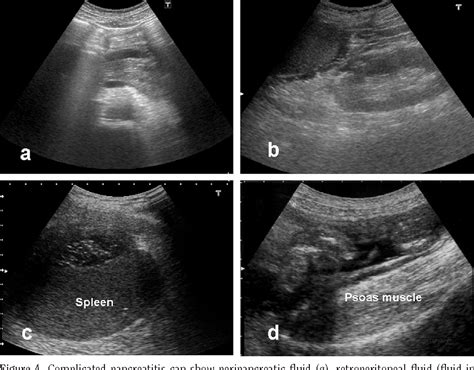 abdominal ultrasound drbeckmann