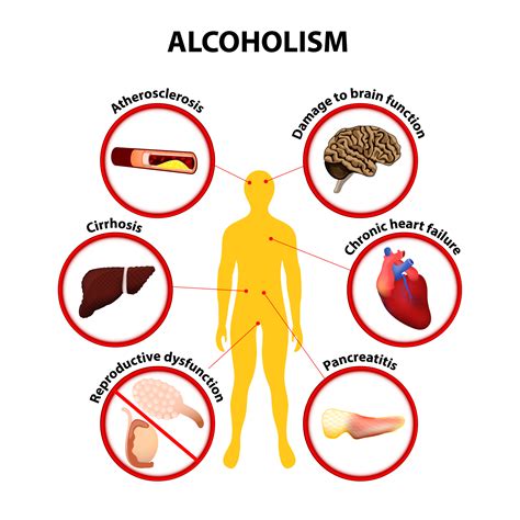 Can Alcoholism Negatively Impact Your Health Racnj