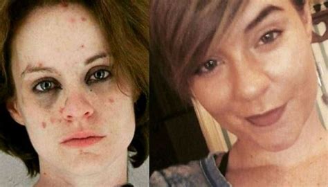 Amazing Transformations Of Former Drug Addicts That Prove Recovery Is Possible