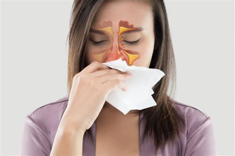 Effective Home Remedies For Sinus Congestion Goqii