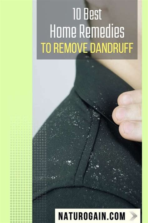 10 Best Home Remedies To Remove Dandruff Fast Naturally