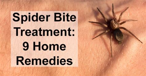 Spider Bite Treatment 9 Home Remedies David Avocado Wolfe