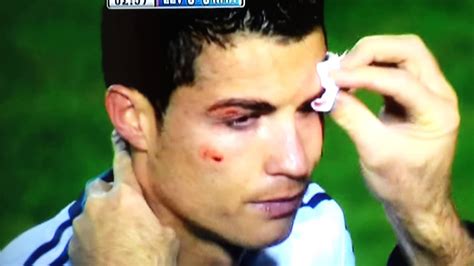 Videos album of cr9 : Golpe sangra a CR7 2012 vs Levante - YouTube
