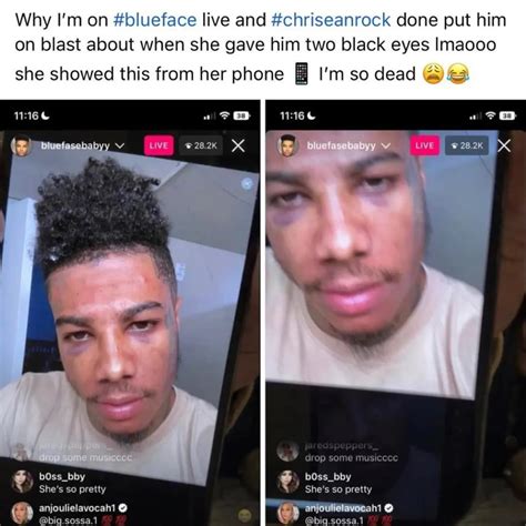 Chrisean Rock Shows Off Black Eye She Allegedly Gave Rapper Blueface