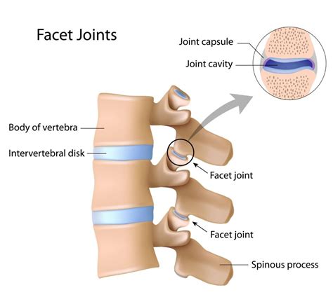 so you have a disc bulge what does it mean for you super spine