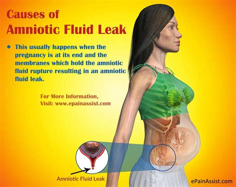 Amniotic Fluid Leak Causes Signs Treatment