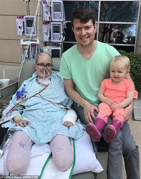Your body's defense system normally what increases my risk for sepsis? Brave mother had her lower legs amputated due to sepsis ...