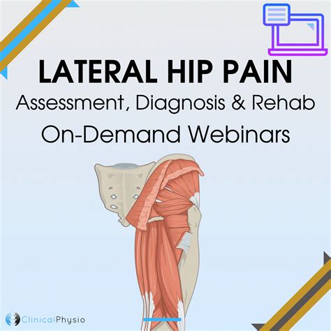 Lateral Hip Pain On Demand Webinars Clinical Physio