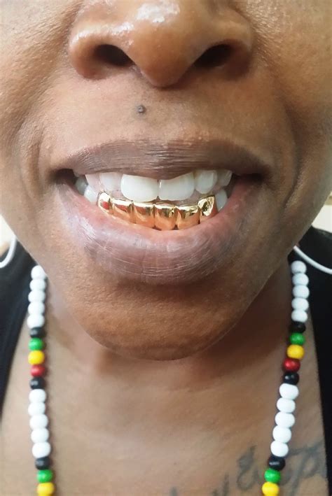 Miami rapper, ballgreezy, sits down with dj smallz and explains why and when he got his permanent gold teeth, how much they cost, weighs in on pull out gold. Gold Grillz Miami Located on 1754 NE 163rd Street North Miami Beach, FL 33162 Call/ Text 305.989 ...