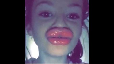 kylie jenner lip challenge fix famous person