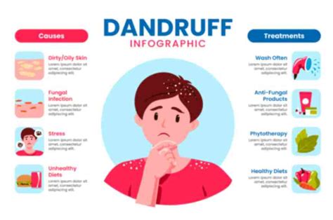 Types Of Dandruff Causes Treatments And Prevention Tips