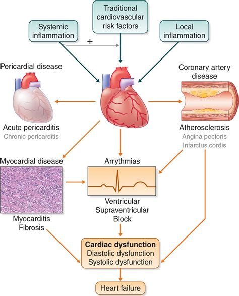Cardiac Involvement In Adult And Juvenile Idiopathic Inflammatory