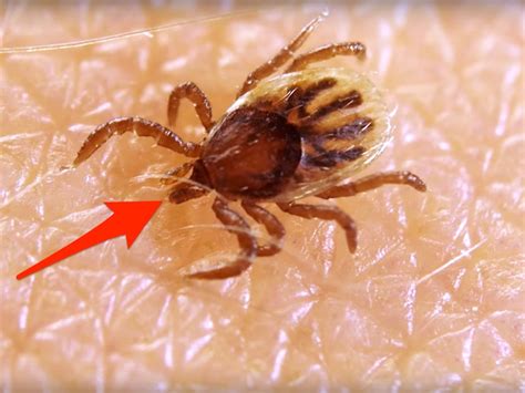 Can A Tick Burrow Under The Skin Of A Dog