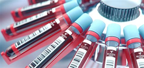 Blood Test For Multi Cancer Screening Has Impressive Success Rate