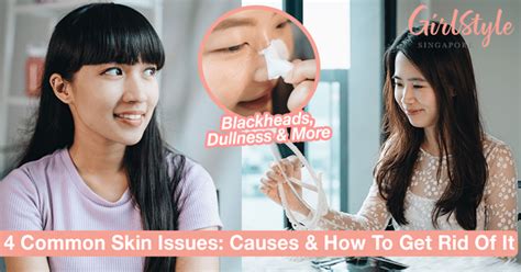 The Causes Of 4 Common Skin Problems And How To Get Rid Of Them Girlstyle Singapore