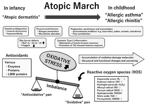 Children Free Full Text Current Insights Into Atopic March