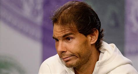 New Rafa Nadal Hair Loss Video Showing Serious Balding
