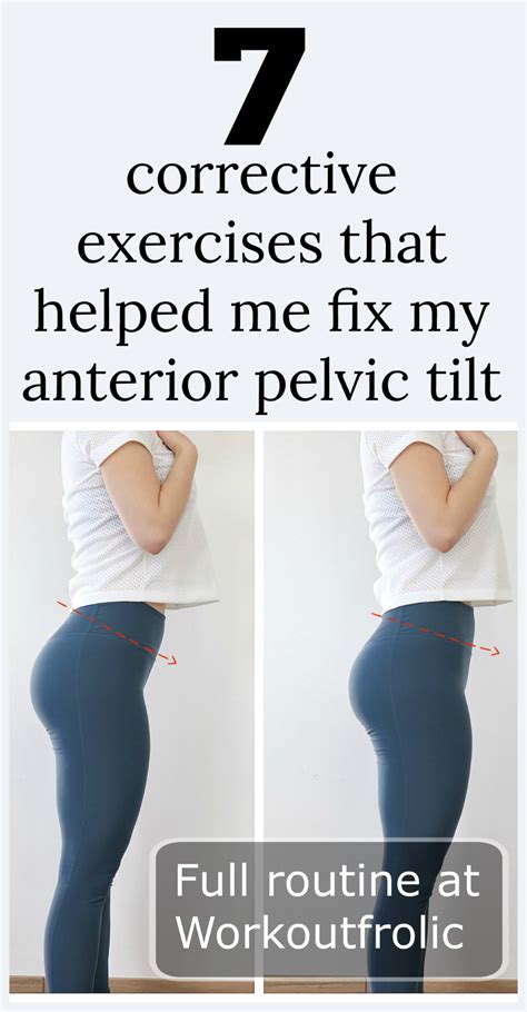 Corrective Exercises To Fix Your Anterior Pelvic Tilt In Fix Your Posture Pelvic Tilt