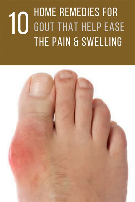 10 Home Remedies For Gout That Help Ease The Pain And Swelling