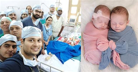 Surgeons Shared A Selfie After Successfully Performing Separation Surgery On 3 Day Old Conjoined