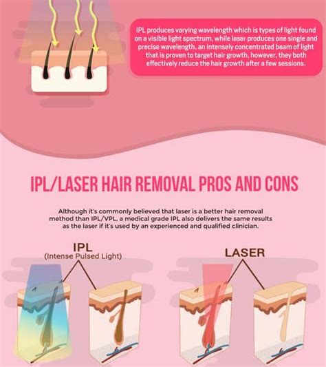 The Ultimate Guide To Laser Ipl Hair Removal Pros Cons And More