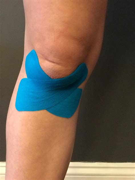 How To Apply Kt Tape To Knee Cap