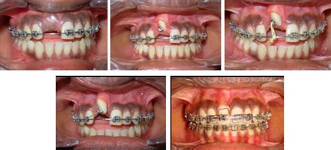 Official page of oral and maxillofacial surgery. Oral & Maxillofacial Surgery - Dr Julians