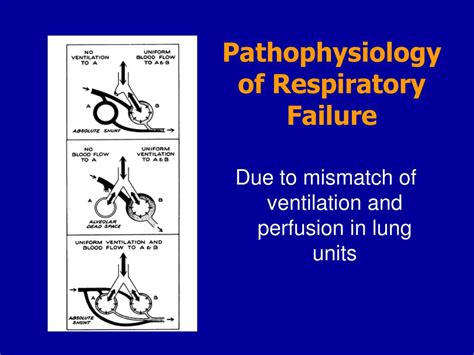 Ppt Hypoxia Respiratory Failure And Altered Mental Status Powerpoint Presentation Id 2967284