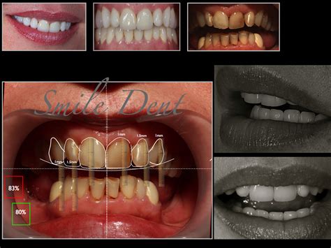 Clinica Stomatologică Smile Dent Estetica Dentara