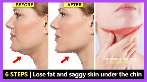Get Rid Of The Fat And Saggy Skin Under The Chin Lose Double Chin Fast Tighten Chin And