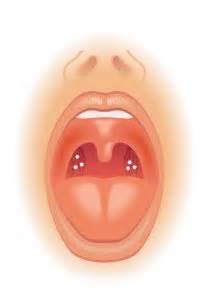 Stare de uscaciune a cavitatii bucale, determinata de scaderea masiva sau de disparitia secretiei salivare. Slechte Adem door Droge Mond? | 5 Tips