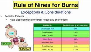 Rule Of Nines For Burns Child And Chart Calculator Definition