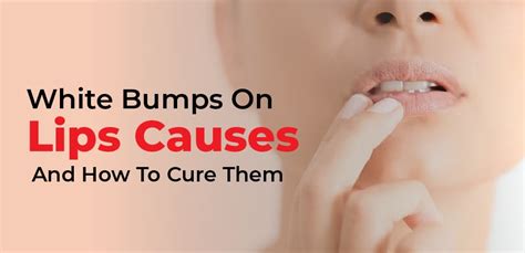 White Bumps On Lips Causes And How To Cure Them Healthy House Ideas