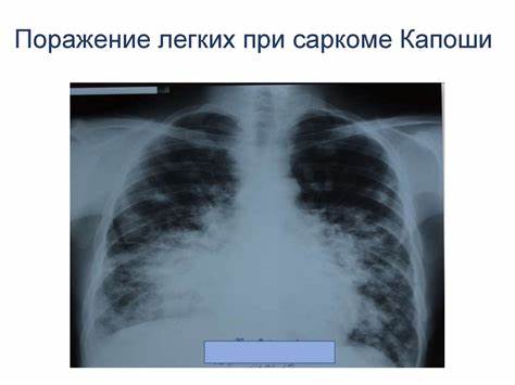 ВИЧ-инфекция. Клиническое течение - online presentation Картинка - ВИЧ-инфекция. Клиническое течение - online presentation