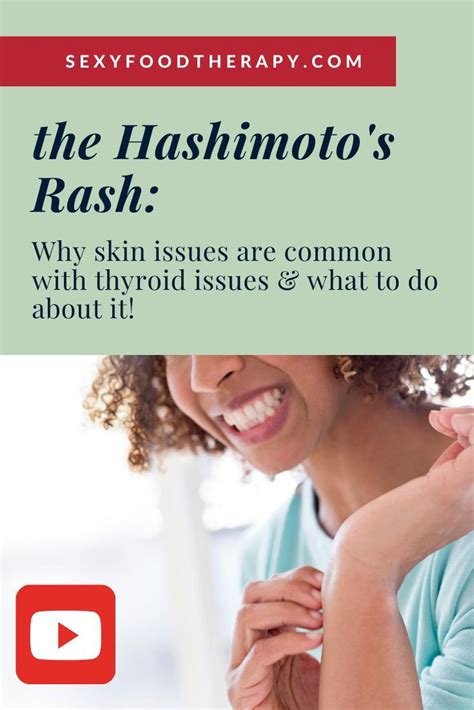 The Hashimotos Rash Why Skin Issues Are Common And What To Do About