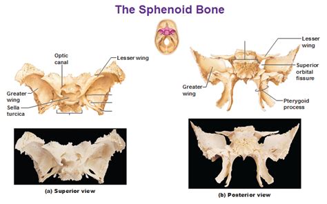 Sphenoid Bone Superior And Posterior Views Greater Lesser Wings Sella