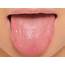 How To Treat Pimples On Tongue  Styles At Life
