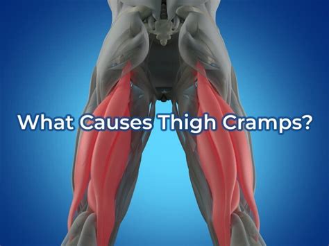 Thigh Cramps 6 Possible Causes Symptoms Treatments And Prevention