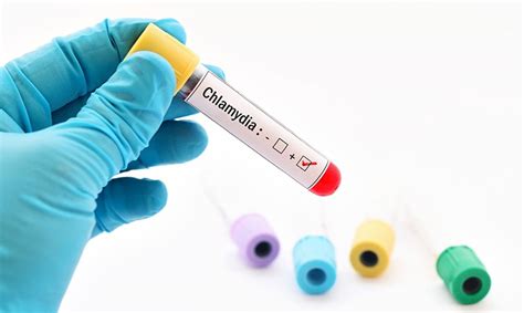 Chlamydia Testing And Common Testing Methods