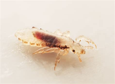 Head Lice 101 Symptomstreatment And Prevention