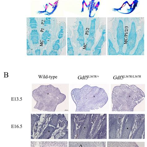 Joint Formation Abnormalities In Gdf5 Sym1 Mice During Limb