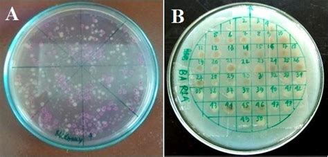Representative Culture Plates Showing Enterobacteriaceae Members